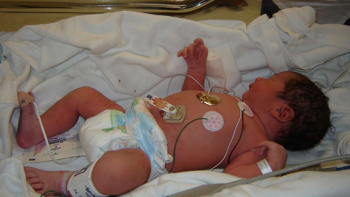 Edición Genética de 8 Bebes para corregirles un transtorno raro